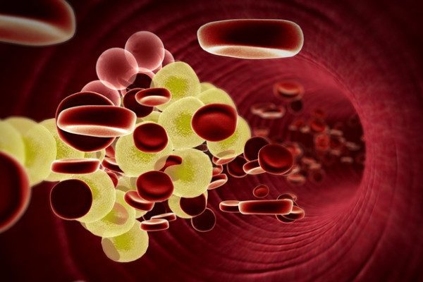 colesterol-600x400 10 trucuri simple ca să scazi colesterolul